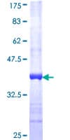 Human PLA2G3 Protein (Recombinant GST, N-terminus)