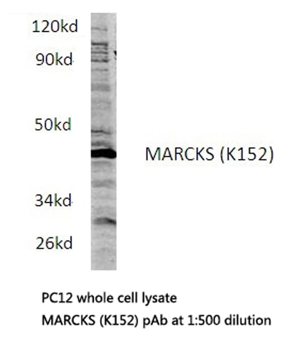 Polyclonal Rabbit anti-Human MARCKS Antibody (Lys152, IF, WB)