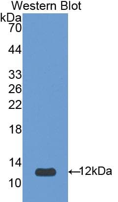 SERPINA12 / Vaspin Antibody (aa52-143)