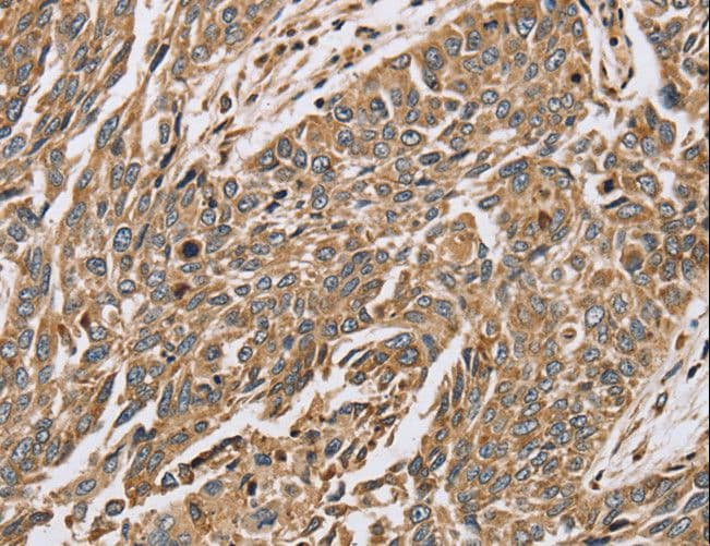 IHC-plus™ Polyclonal Rabbit anti-Human PTGER2 / EP2 Antibody (IHC, WB)
