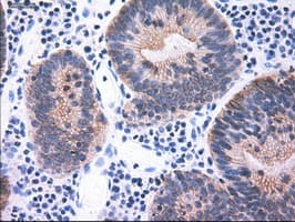 KRT18 / CK18 / Cytokeratin 18 Antibody (clone OTI1E1)