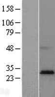 Human HACD4 / PTPLAD2 Protein (Over-Expression Lysate Myc-DDK (Flag))