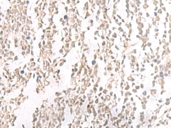 Polyclonal Rabbit anti-Human PTEN Antibody (IHC, WB)