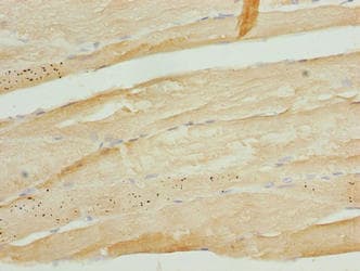 TRIM55 / MURF2 Antibody