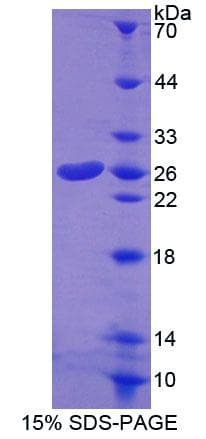 Mouse COT / CROT Protein (Recombinant His-T7)