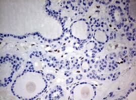 ZEB1 / AREB6 Antibody (aa1-350, clone OTI7E12)