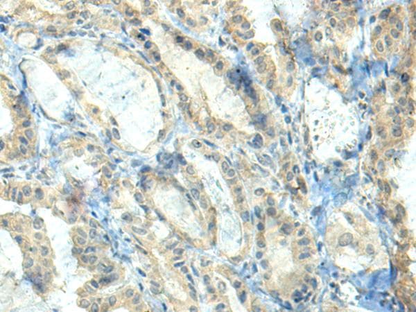 Polyclonal Rabbit anti-Human CTDP1 / FCP1 Antibody (IHC)