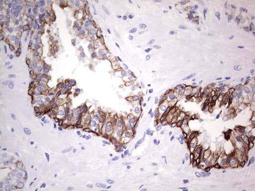 Monoclonal Mouse anti-Human KRT19 / CK19 / Cytokeratin 19 Antibody (clone OTI5F4, aa240-390, IHC, WB)