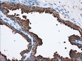 Monoclonal Mouse anti-Human PANK2 Antibody (clone OTI3H9, IHC, IF, WB)