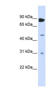 ADAR2 / ADARB1 Antibody (N-Terminus)