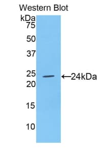 CNTF Antibody (aa2-198)