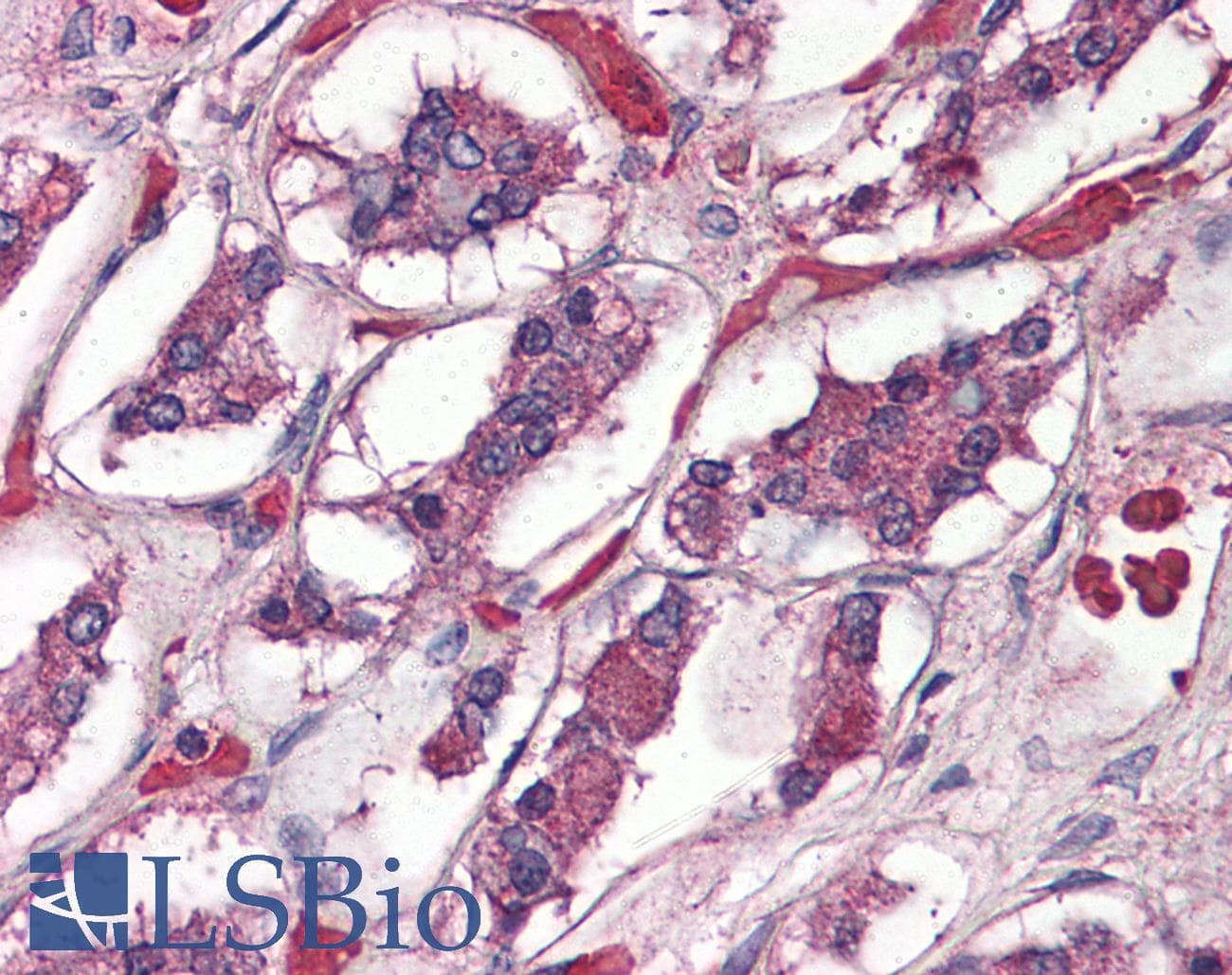 IHC-plus™ ADCYAP1R1 / PAC1 Receptor Antibody (N-Terminus)
