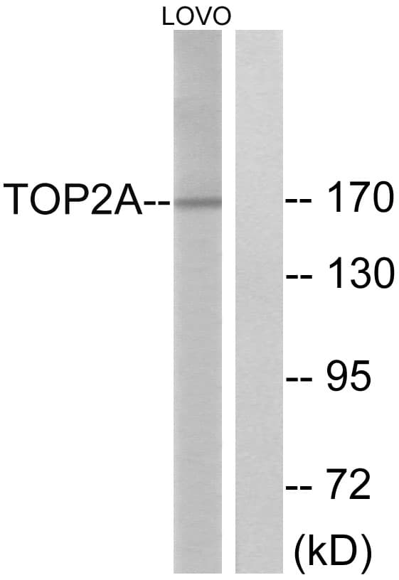 TOP2A / Topoisomerase II Alpha Antibody (aa1081-1130)