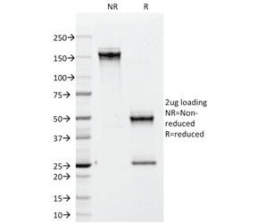 Monoclonal Mouse anti-Human CD79B / CD79 Beta Antibody (clone IGB/1842, IHC)