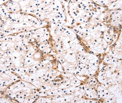 Polyclonal Rabbit anti-Human PDCD10 Antibody (IHC, WB)