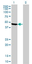 PathPlus™ ENO1 / Alpha Enolase Antibody (clone 8G8)