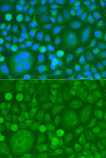 EPM2A / Laforin Antibody