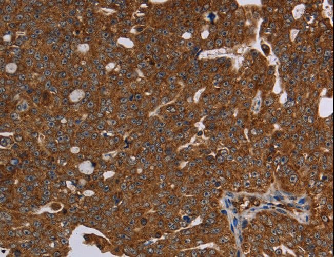 HSD17B13 Antibody