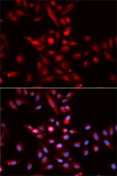 Polyclonal Rabbit anti-Human CDKN1B / p27 Kip1 Antibody (IHC, IF, WB)