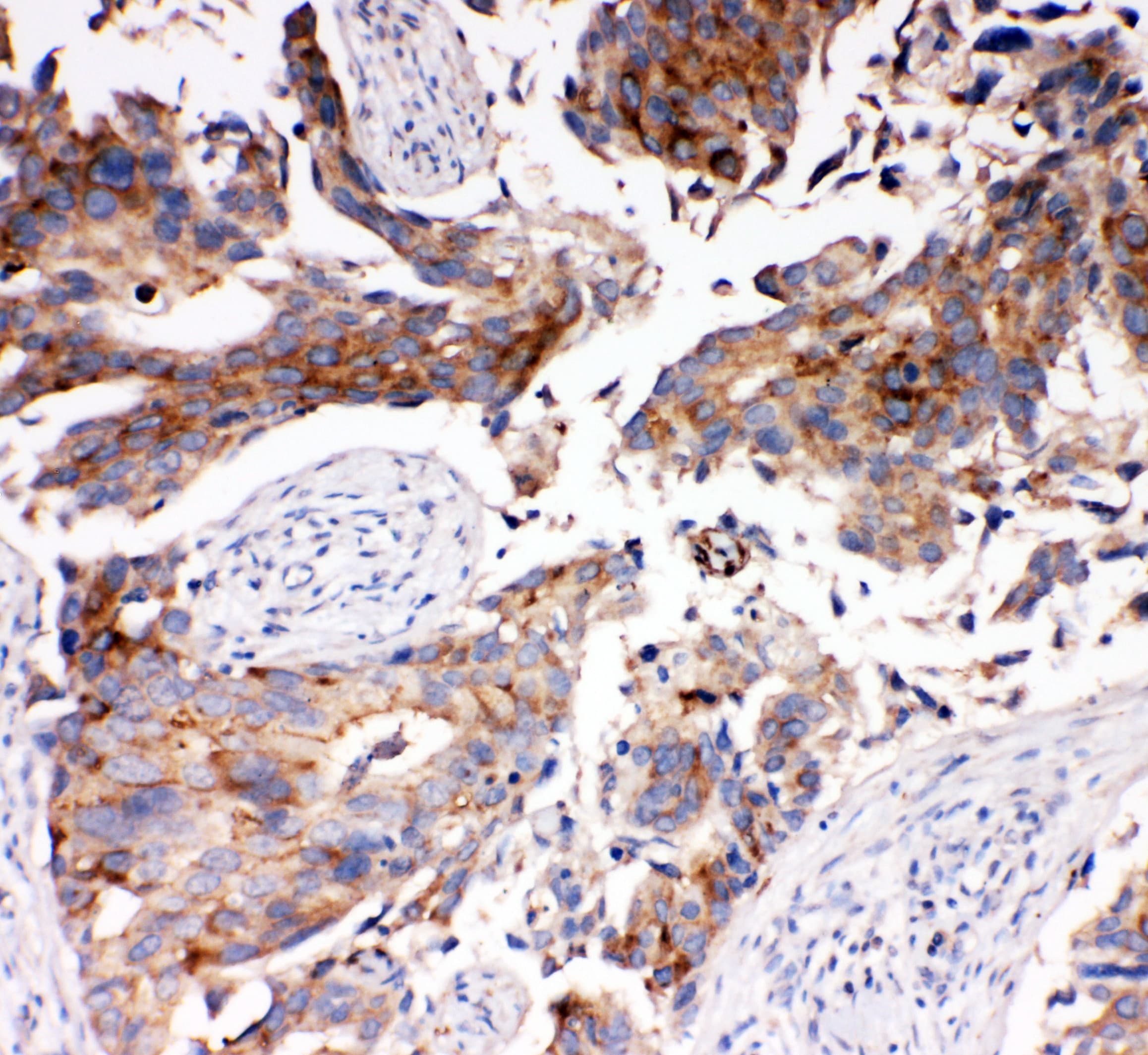 Polyclonal Rabbit anti-Human SLC16A4 Antibody (aa134-148, IHC, WB)