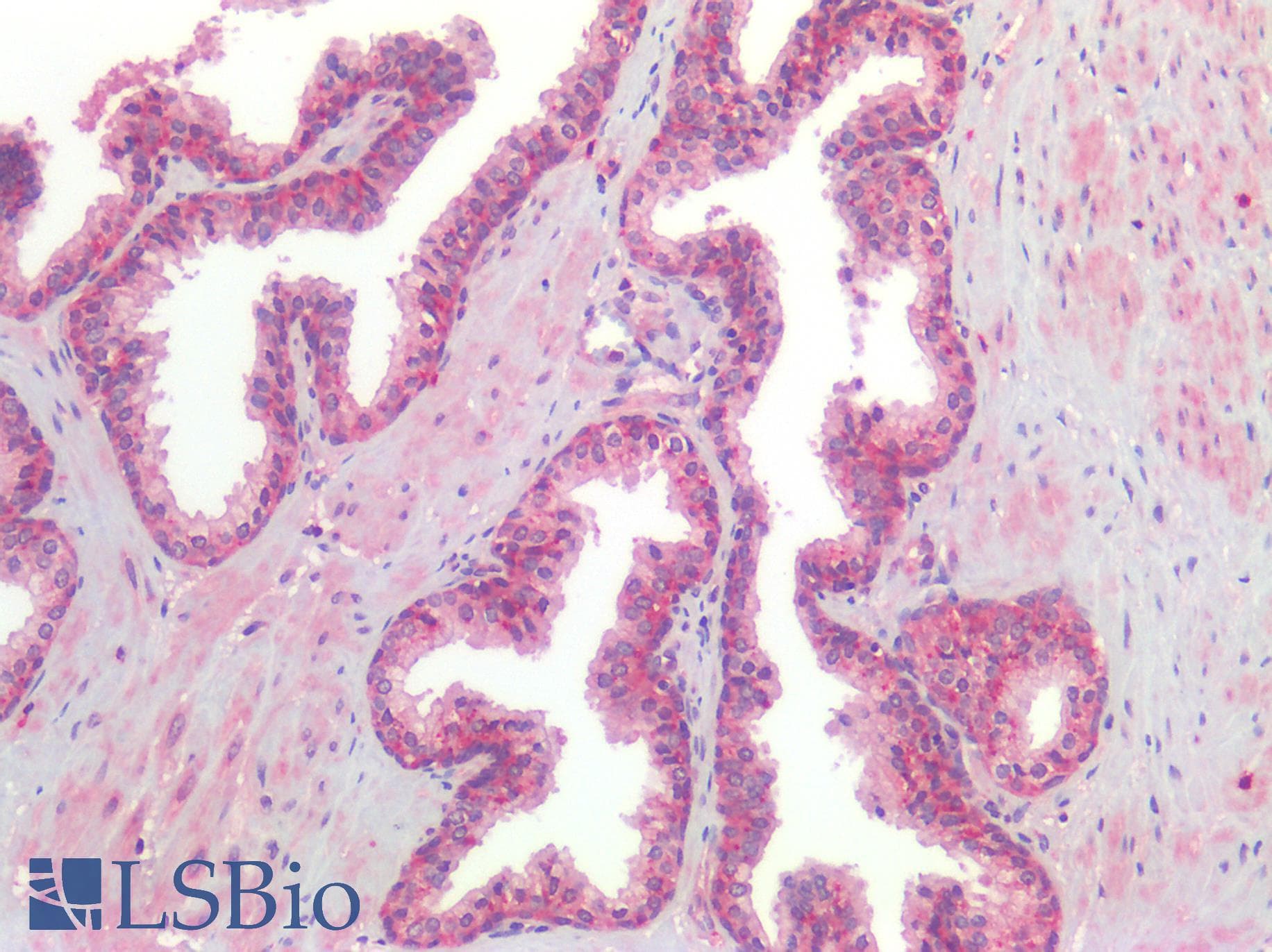 PathPlus™ GPR160 Antibody (Extracellular Domain)
