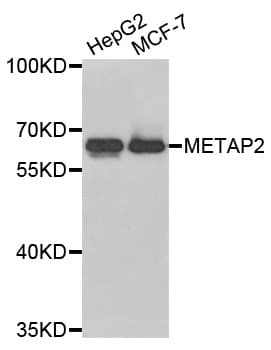METAP2 Antibody (AP)