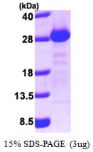Human GOPC / PIST Protein (Recombinant His)