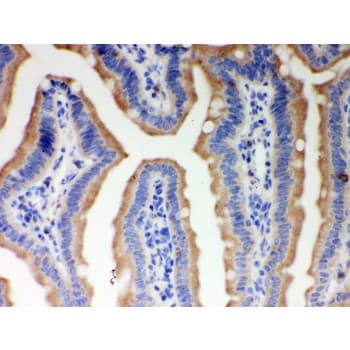 Polyclonal Rabbit anti-Human ITPR3 Antibody (aa70-95, IHC, WB)