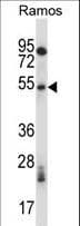 PHKG1 Antibody (aa302-331)