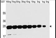 Monoclonal Mouse GST / Glutathione S-Transferase Antibody (WB)