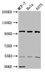 EIF3C / EIF3S8 Antibody