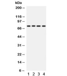 Polyclonal Rabbit anti-Human PRKCH / PKC-Eta Antibody (WB)
