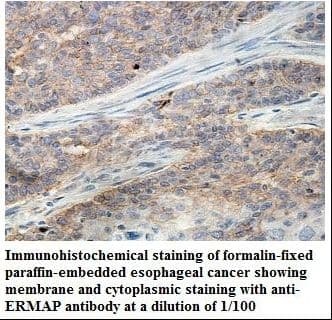 ERMAP / SC Antibody (aa304-467)