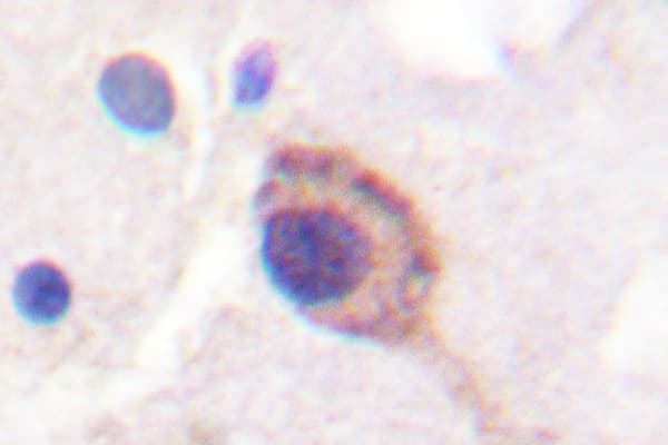 ATP1A1 Antibody (Tyr10)