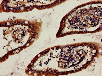 HTR1A / 5-HT1A Receptor Antibody