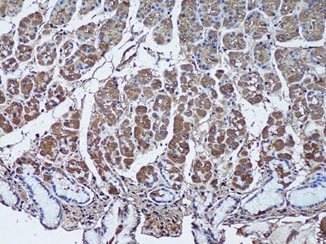 SFRP1 Antibody
