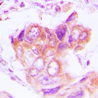 Polyclonal Rabbit anti-Human PSMD2 Antibody (N-Terminus, IHC, WB)