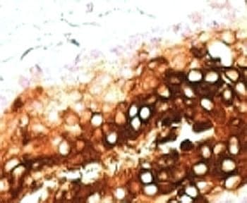 KRT17 / CK17 / Cytokeratin 17 Antibody (clone SPM560)