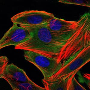 IHC-plus™ RPS6KA3 / RSK2 Antibody (clone 4E10)