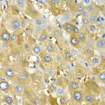 Polyclonal Rabbit anti-Human CHIA / Amcase Antibody (IHC, WB)