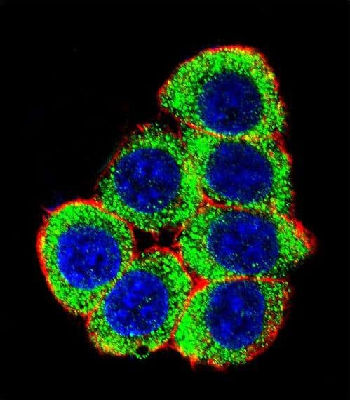 Polyclonal Rabbit anti-Human XRCC6 / Ku70 Antibody (aa228-254, IHC, IF, WB)