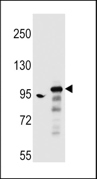 ARHGAP27 Antibody (aa198-226)