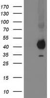 PON1 / ESA Antibody (clone OTI1F7)
