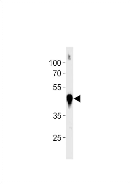 ACTB / Beta Actin Antibody (aa188-215)