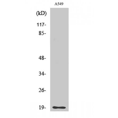 CD3D Antibody (Internal)