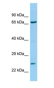 Polyclonal Rabbit anti-Human TNK1 Antibody (aa517-566, IHC, WB)