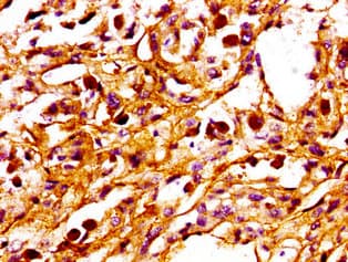 Polyclonal Rabbit anti-Human PPM1F Antibody (IHC, IF, WB)
