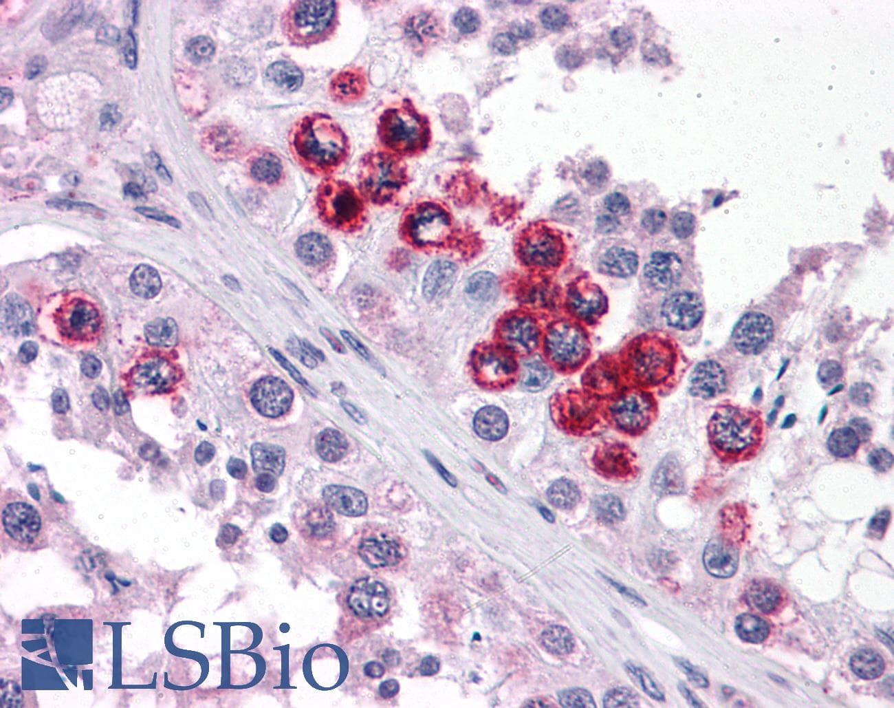 IHC-plus™ Polyclonal Rabbit anti-Human ZNF687 Antibody (IHC)