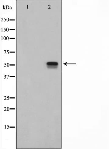 PEA3 / ETV4 Antibody