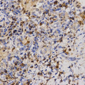 EIF2AK2 / PKR Antibody